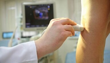 Tratamiento con láser de venas varicosas