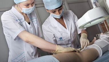 Tratamiento quirúrgico de las venas varicosas